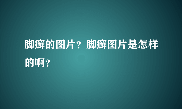 脚癣的图片？脚癣图片是怎样的啊？