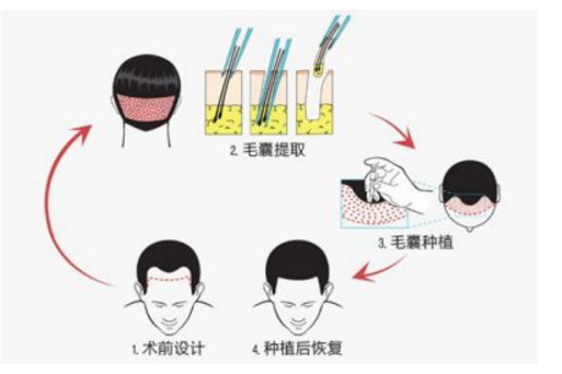 头发加密是怎样进行的