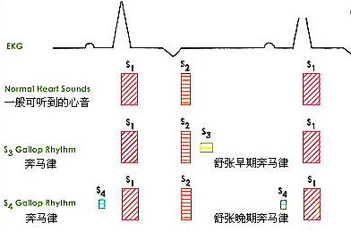 什么是奔马律?说明什么问题?