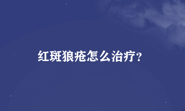 红斑狼疮怎么治疗？