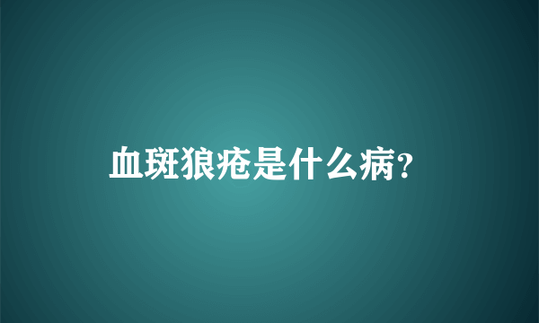 血斑狼疮是什么病？