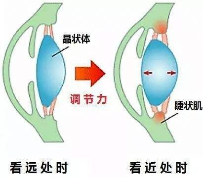 怎样恢复眼睛视力