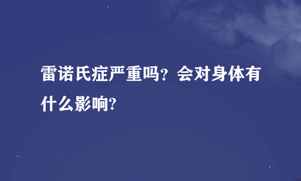 雷诺氏症严重吗？会对身体有什么影响?